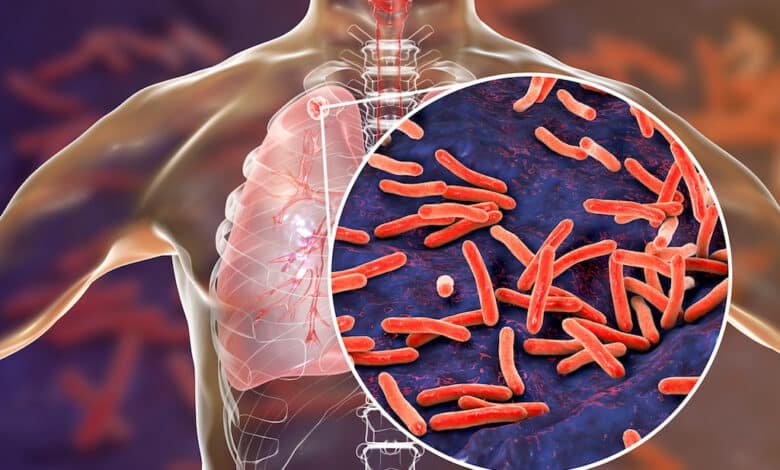 Philippines is eradicating tuberculosis with India's cooperation