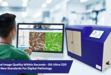 OptraSCAN receives US FDA 510(k) clearance