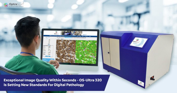 OptraSCAN receives US FDA 510(k) clearance